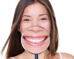 Ventajas y desventajas del blanqueamiento dental